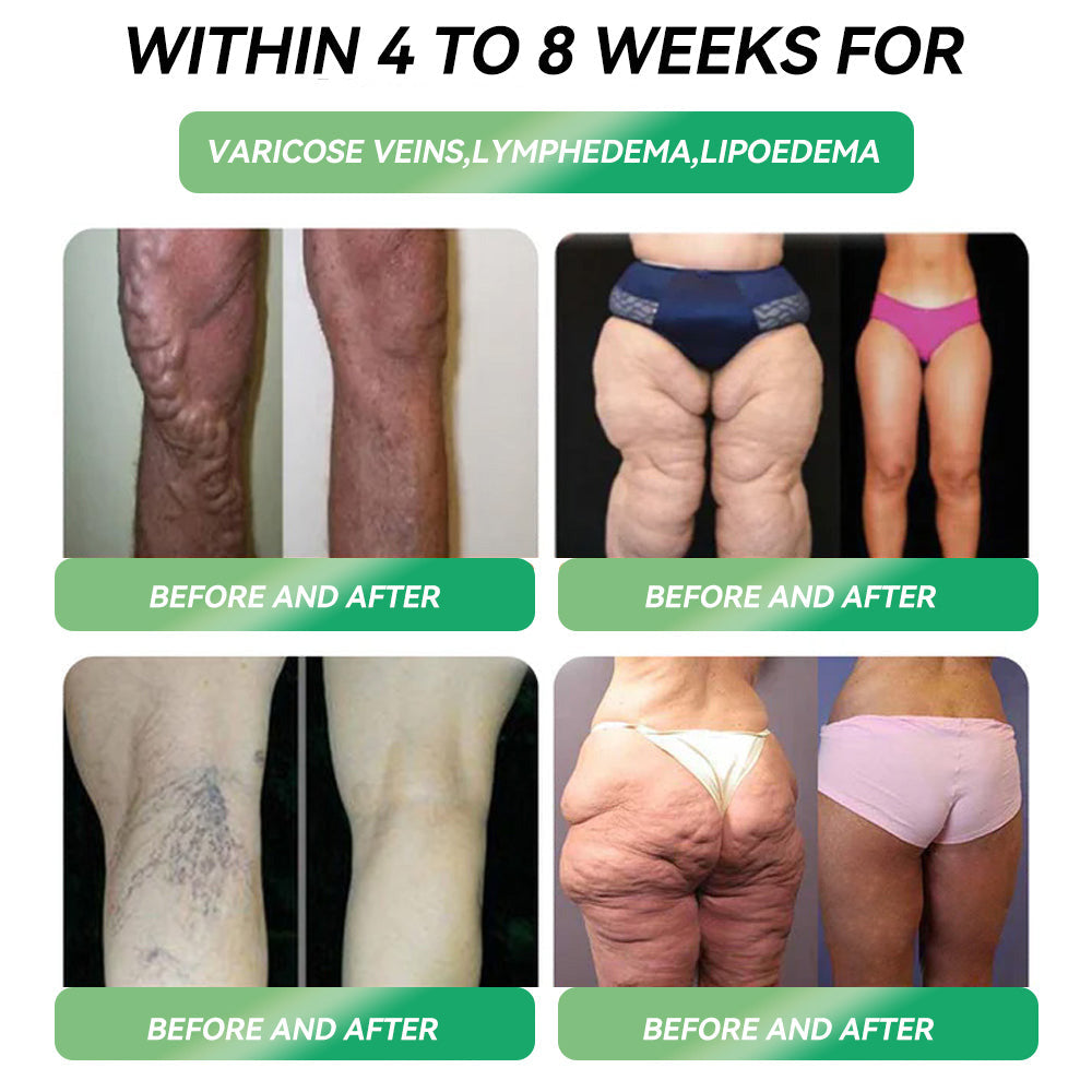 โฐ Only 1 Spot Left! ๐ฅ Extra 30% OFF! STDEIยฎ GLP-1 Weight Loss Oral Solution ๐จโโ๏ธ