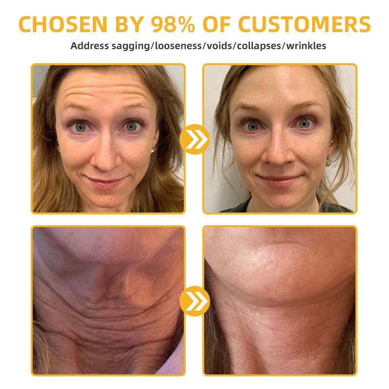 STDEI™ Bee Lift Anti-Aging Firming Cream,Address Crepe & Sagging(🔥Price as low as $9.99 AUD per bottle)🎄🎄