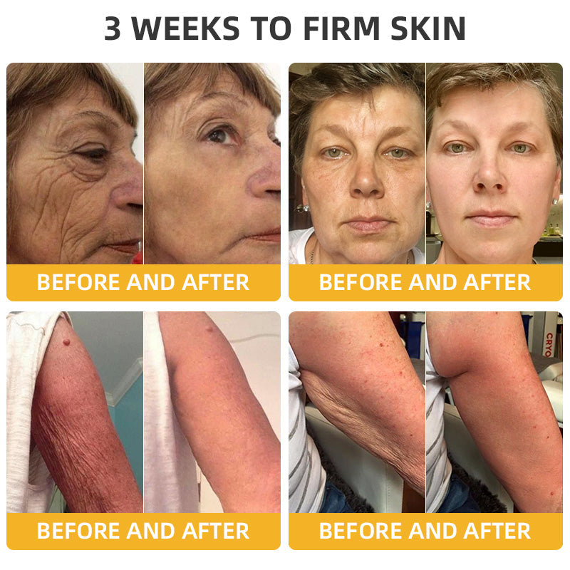STDEI™ Bee Lift Anti-Aging Firming Cream,Address Crepe & Sagging(🔥Price as low as $9.99 AUD per bottle)🎄🎄