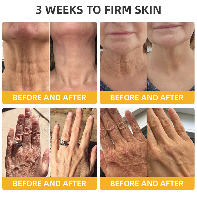 STDEI™ Bee Lift Anti-Aging Firming Cream,Address Crepe & Sagging(🔥Price as low as $9.99 AUD per bottle)🎄🎄