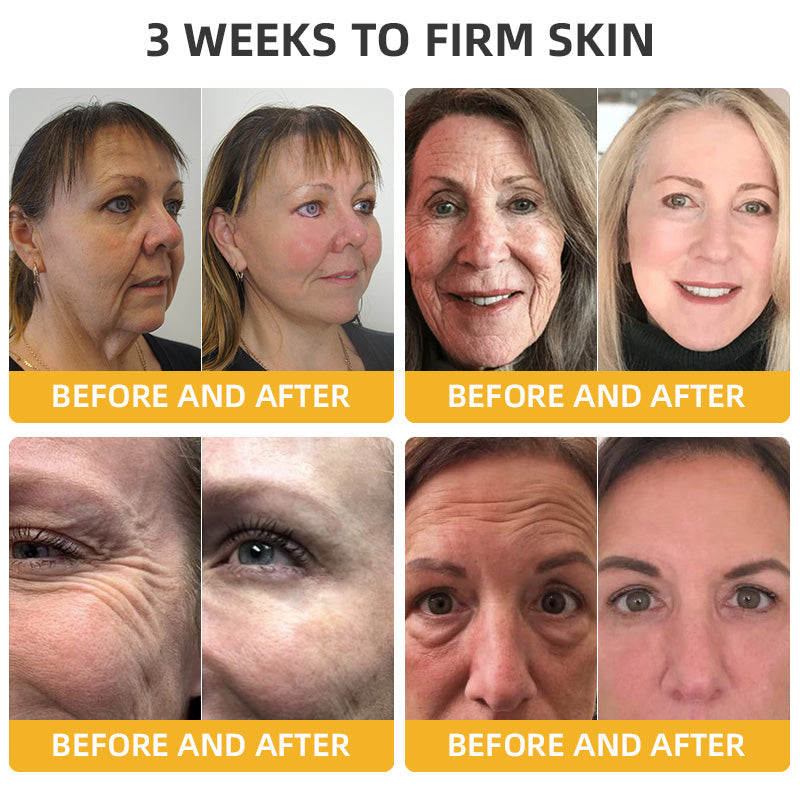 STDEI™ Bee Lift Anti-Aging Firming Cream,Address Crepe & Sagging(🔥Price as low as $9.99 AUD per bottle)🎄🎄
