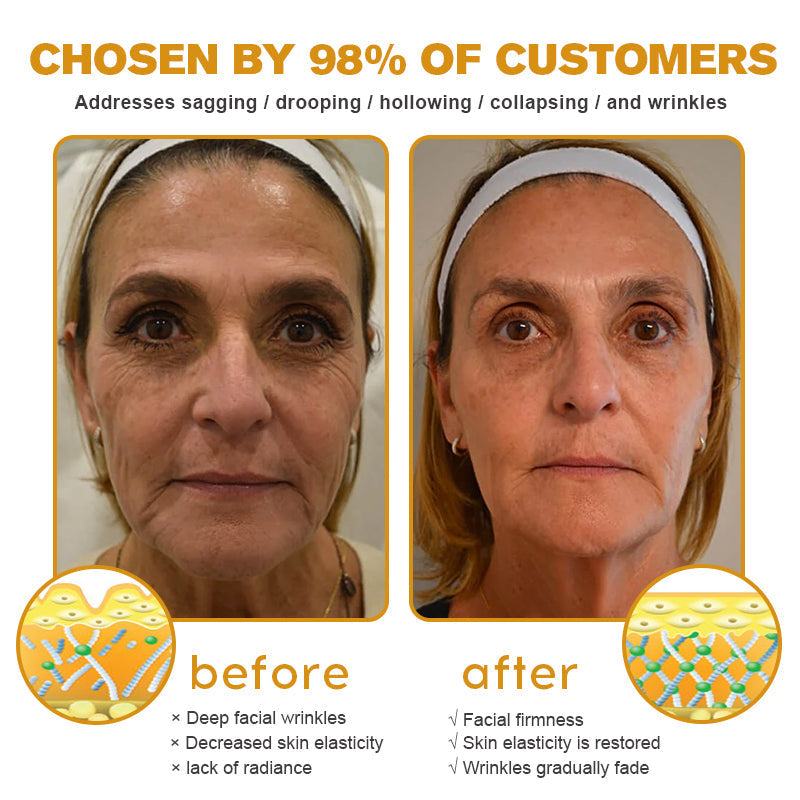 (Made in Australia, shipped from Australia✅)𝐒𝐩𝐳𝐯™𝐁𝐨𝐭𝐨𝐱 𝐁𝐞𝐞 𝐕𝐞𝐧𝐨𝐦 𝐖𝐫𝐢𝐧𝐤𝐥𝐞 𝐑𝐞𝐦𝐨𝐯𝐚𝐥 𝐂𝐫𝐞𝐚𝐦- LAST DAY 70% OFF