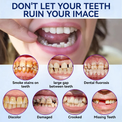 𝐁𝐢𝐤𝐞𝐧𝐝𝐚®-🦷𝐀𝐝𝐯𝐚𝐧𝐜𝐞𝐝 𝐂𝐮𝐬𝐭𝐨𝐦𝐢𝐳𝐞𝐝 𝐅𝐮𝐥𝐥 𝐃𝐞𝐧𝐭𝐮𝐫𝐞 𝐒𝐞𝐭🦷 (⏰Limited time discount last 30 minutes⏰)🍁💖