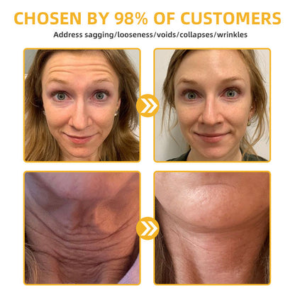 STDEI™ 🔥🔥Bee Lift Anti-Aging Firming Cream,Address Crepe & Sagging(🔥74% Off for a Limited Time! )