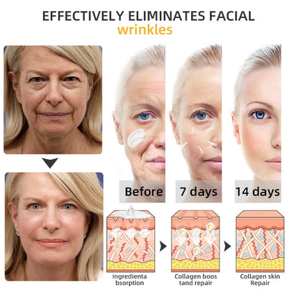STDEI™ 🔥🔥Bee Lift Anti-Aging Firming Cream,Address Crepe & Sagging(🔥74% Off for a Limited Time! )